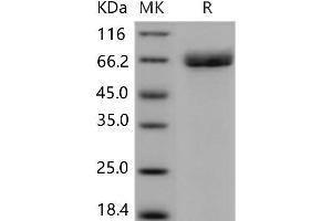 Western Blotting (WB) image for Acetylcholinesterase (AChE) (Active) protein (His tag) (ABIN7320239) (Acetylcholinesterase Protein (AChE) (His tag))