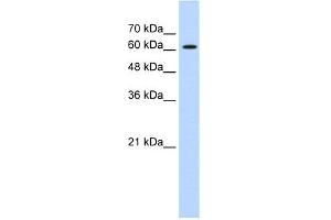 WB Suggested Anti-ZIC2 Antibody Titration:  0. (ZIC2 抗体  (C-Term))