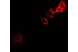 Immunofluorescent analysis of PGM1 staining in U2OS cells. (Phosphoglucomutase 1 抗体)
