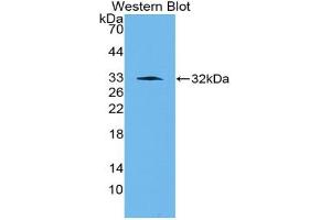 Western blot analysis of the recombinant protein. (PAI1 抗体  (AA 141-389))