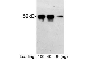 Loading: S-tag fusion protein expressed in E. (S-Tag 抗体)