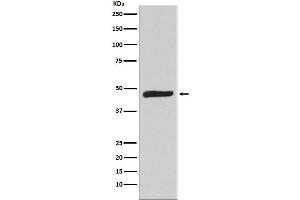 Western blot analysis of MAPKAP Kinase 2 expression in Hela cell lysate.