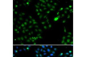 Immunofluorescence analysis of HeLa cells using FKBP3 Polyclonal Antibody (FKBP3 抗体)