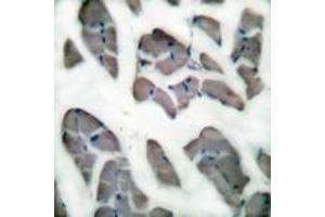 Immunohistochemistry analysis of paraffin-embedded human skeletal muscle tissue, using Desmin Antibody. (Desmin 抗体  (AA 421-470))