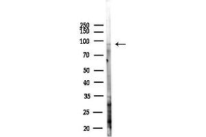 Western blot analysis of lysates from Hela cells(heat-shock,45 min treatment), using CNKSR1 Antibody at 1/1000 dilution.