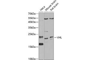 Western blot analysis of extracts of various cell lines, using VHL antibody (ABIN3020967, ABIN3020968, ABIN3020969 and ABIN6213828) at 1:1000 dilution. (VHL 抗体  (AA 1-172))