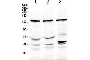 Western blot analysis of Exportin-5 using anti-Exportin-5 antibody . (XPO5 抗体  (N-Term))