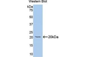 Detection of Recombinant GALC, Human using Polyclonal Antibody to Galactosylceramidase (GALC) (GALC 抗体  (AA 375-535))