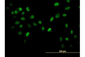 Immunofluorescence of monoclonal antibody to AKT2 on HeLa cell. (AKT2 抗体  (AA 100-189))
