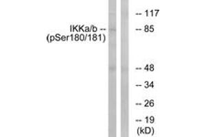 Western blot analysis of extracts from HepG2 cells treated with TNF 20ng/ml 5', using IKK-alpha/beta (Phospho-Ser180/181) Antibody. (IKK-alpha /IKK-beta 抗体  (pSer180))