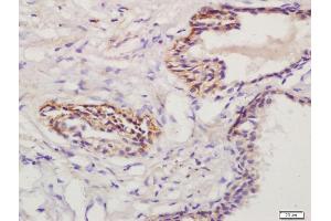 Immunohistochemistry (IHC) image for anti-Prostaglandin E Receptor 1 (Subtype EP1), 42kDa (PTGER1) (AA 61-160) antibody (ABIN872820)