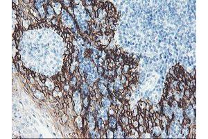 Image no. 3 for anti-FXYD Domain Containing Ion Transport Regulator 3 (FXYD3) antibody (ABIN1498341)