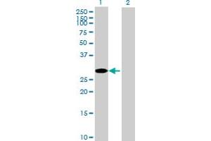 Western Blot analysis of CCS expression in transfected 293T cell line by CCS MaxPab polyclonal antibody. (Superoxide dismutase copper chaperone 抗体  (AA 1-274))
