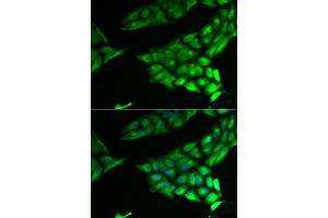 Immunofluorescence analysis of U2OS cells using PSAT1 antibody. (PSAT1 抗体)