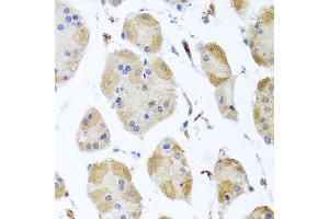 Immunohistochemistry of paraffin-embedded human gastric using MYLK antibody at dilution of 1:100 (x40 lens). (MYLK 抗体)