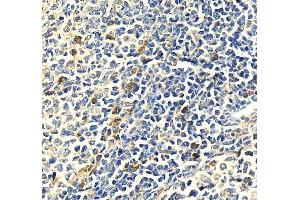 IHC analysis of MPO using anti-MPO antibody (ABIN7602030). (Myeloperoxidase 抗体  (AA 556-697))