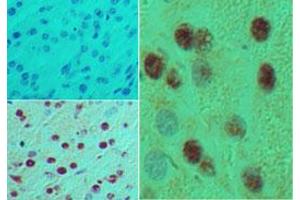 HB9 Immunohistochemistry. (MNX1 抗体)