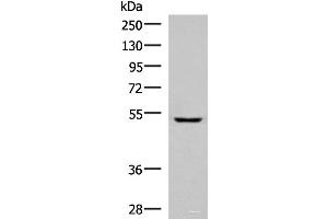 Western blot analysis of Human fetal liver tissue lysate using PISD Polyclonal Antibody at dilution of 1:600 (PISD 抗体)