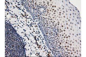 Image no. 15 for anti-Excision Repair Cross-Complementing Rodent Repair Deficiency, Complementation Group 4 (ERCC4) antibody (ABIN1498070)