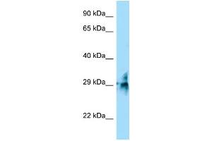 WB Suggested Anti-TMUB2 Antibody Titration: 1. (TMUB2 抗体  (C-Term))