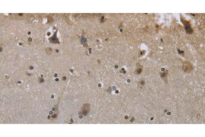 Immunohistochemistry of paraffin-embedded Human brain using GYS1 Polyclonal Antibody at dilution of 1:50 (Glycogen Synthase 1 抗体)