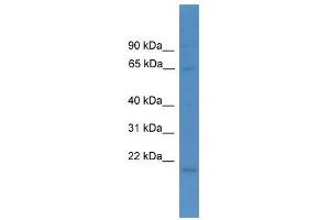 Western Blot showing LTA4H antibody used at a concentration of 1-2 ug/ml to detect its target protein. (LTA4H 抗体  (N-Term))