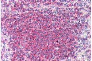 Human Spleen (formalin-fixed, paraffin-embedded) stained with CHEK2 antibody ABIN213892 at 10 ug/ml followed by biotinylated anti-mouse IgG secondary antibody ABIN481714, alkaline phosphatase-streptavidin and chromogen. (CHEK2 抗体)