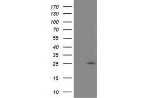 Western Blotting (WB) image for anti-Adenylate Kinase 3 (AK3) antibody (ABIN1496519) (Adenylate Kinase 3 抗体)