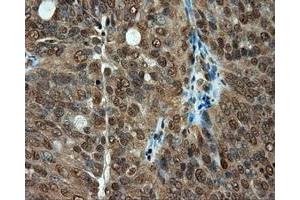 Immunohistochemical staining of paraffin-embedded colon tissue using anti-PSMC3 mouse monoclonal antibody. (PSMC3 抗体)