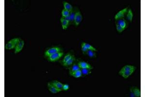 Immunofluorescent analysis of HepG2 cells using ABIN7147915 at dilution of 1:100 and Alexa Fluor 488-congugated AffiniPure Goat Anti-Rabbit IgG(H+L) (CLDN8 抗体  (AA 141-225))