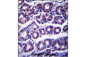 Immunohistochemistry (Paraffin-embedded Sections) (IHC (p)) image for anti-Solute Carrier Family 41, Member 2 (SLC41A2) (AA 35-63), (N-Term) antibody (ABIN657753)