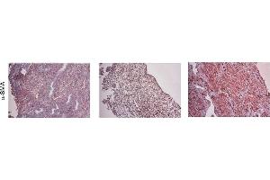Immunohistochemistry (IHC) image for anti-Actin, alpha 2, Smooth Muscle, Aorta (ACTA2) (N-Term) antibody (ABIN2857027)