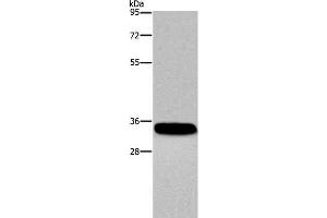 Western Blot analysis of Human normal lung tissue using CA4 Polyclonal Antibody at dilution of 1:300 (CA4 抗体)