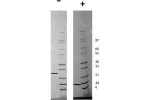 SDS-PAGE of Human Artemin Recombinant Protein SDS-PAGE of Human Artemin Recombinant Protein. (ARTN 蛋白)