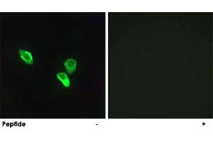 Immunofluorescence analysis of MCF-7 cells, using MRPS18C polyclonal antibody . (MRPS18C 抗体)