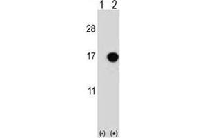 Western blot analysis of CDKN2B antibody and 293 cell lysate either nontransfected (Lane 1) or transiently transfected (2) with the CDKN2B gene. (CDKN2B 抗体  (AA 102-130))