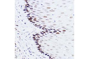 Immunohistochemistry of paraffin-embedded human esophageal using p73 Rabbit mAb (ABIN1678945, ABIN1678944, ABIN7101487 and ABIN7101488) at dilution of 1:100 (40x lens). (Tumor Protein p73 抗体)