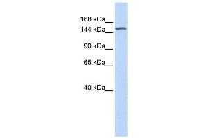 DGKH antibody used at 1 ug/ml to detect target protein. (DGKH 抗体  (Middle Region))