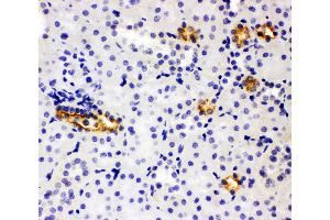 Anti-SLC12A1 antibody, IHC(P) IHC(P): Rat Kidney Tissue (SLC12A1 抗体  (N-Term))
