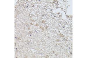 Immunohistochemistry of paraffin-embedded rat brain using PP2A-B56δ/PR61δ/PP2A-B56δ/PR61δ/PPP2R5D antibody (ABIN7269690) at dilution of 1:100 (40x lens). (PPP2R5D 抗体  (AA 450-550))