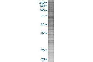 ENPP5 transfected lysate. (ENPP5 293T Cell Transient Overexpression Lysate(Denatured))
