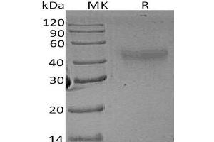 Western Blotting (WB) image for Colony Stimulating Factor 1 (Macrophage) (CSF1) protein (ABIN7321260) (M-CSF/CSF1 蛋白)