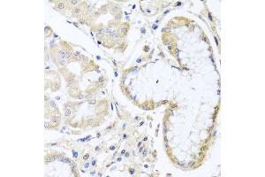 Immunohistochemistry of paraffin-embedded human gastric using INPP5K antibody at dilution of 1:100 (x40 lens). (INPP5K 抗体)