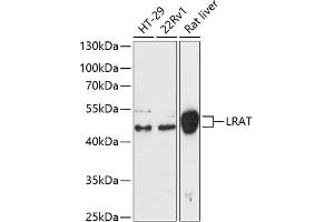 Western blot analysis of extracts of various cell lines, using Lrat antibody (ABIN6132017, ABIN6143311, ABIN6143314 and ABIN6217073) at 1:3000 dilution. (LRAT 抗体  (AA 31-150))