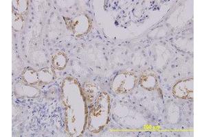 Image no. 1 for anti-Solute Carrier Family 25 (Mitochondrial Carrier, Oxoglutarate Carrier), Member 11 (SLC25A11) (AA 1-315) antibody (ABIN599038)