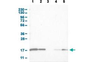 Western Blot analysis of (1) human cell line RT-4 (2) human cell line U-251MG sp (3) human plasma (IgG/HSA depleted) (4) human liver tissue, and (5) human tonsil tissue. (CNTF 抗体  (AA 105-198))