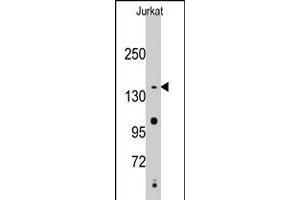 Western blot analysis of SMC2 polyclonal antibody  in Jurkat cell line lysates (35 ug/lane). (SMC2 抗体  (C-Term))