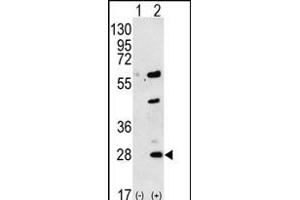 Western blot analysis of GREM1 (arrow) using rabbit polyclonal GREM1 Antibody (C-term) (ABIN656181 and ABIN2845510). (GREM1 抗体  (C-Term))