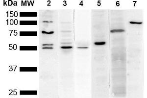 Western Blot analysis of Human Cervical cancer cell line (HeLa) lysate showing detection of Multiple KDEL protein using Mouse Anti-KDEL Monoclonal Antibody, Clone 2C1 (ABIN5650522). (KDEL 抗体  (N-Term) (Biotin))