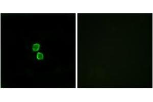 Immunofluorescence analysis of MCF7 cells, using CKLF1 Antibody. (CKLF 抗体  (AA 120-169))